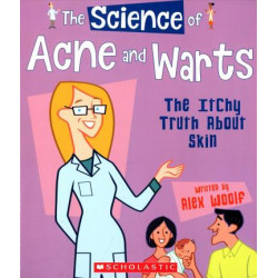 The Science of Acne and Warts