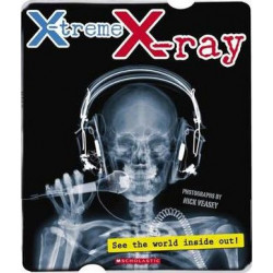 X-Treme X-Ray