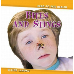 Bites and Stings