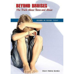 Beyond Bruises