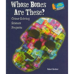 Whose Bones Are These?