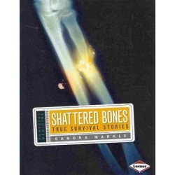 Shattered Bones