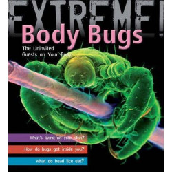 Extreme Science: Body Bugs!