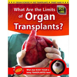 What Are the Limits of Organ Transplants?