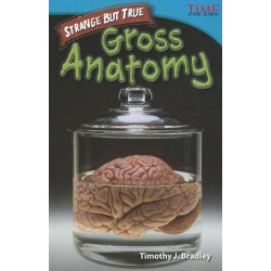 Strange but True: Gross Anatomy