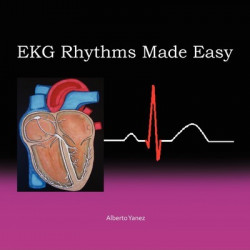EKG Rhythms Made Easy