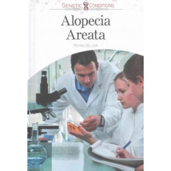 Alopecia Areata