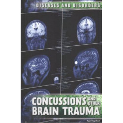 Concussions and Other Brain Trauma