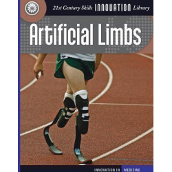 Artificial Limbs
